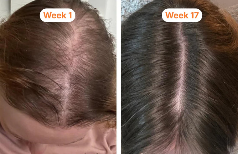 after 17 weeks of use