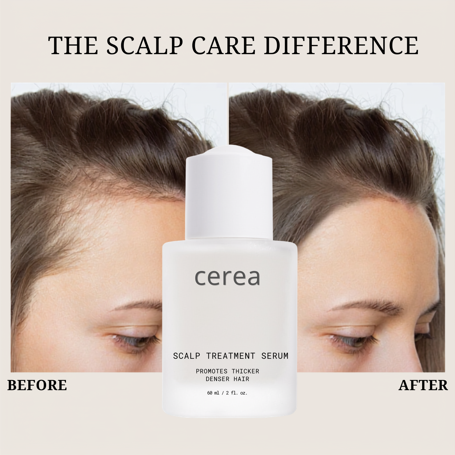 Scalp serum